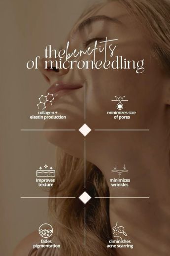 Close-up of person receiving microneedling beauty treatment in a clinic.